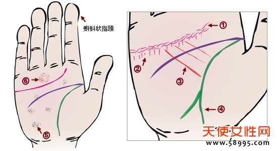 βиβߣѪɫϵаϰߡ(졢ء)ʻɫɫ״̬״ֶвѡߵ㣬Ǹβ